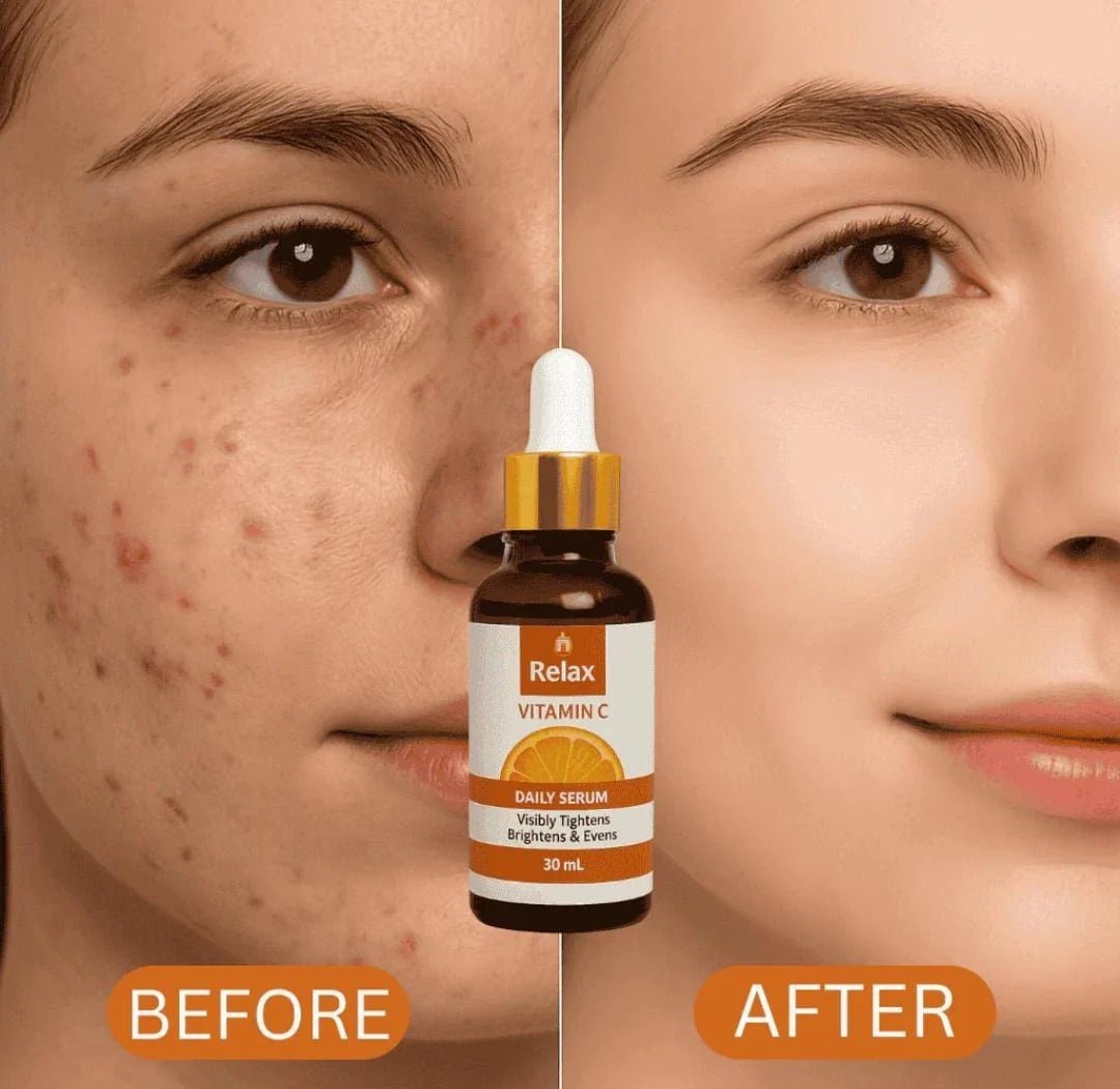 Relax Vitamin C Daily Serum - 30ml | Visibly Brightens, Evens Skin Tone - Furnixs Shop