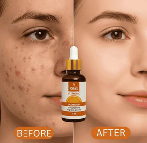 Relax Vitamin C Daily Serum - 30ml | Visibly Brightens, Evens Skin Tone - Furnixs Shop
